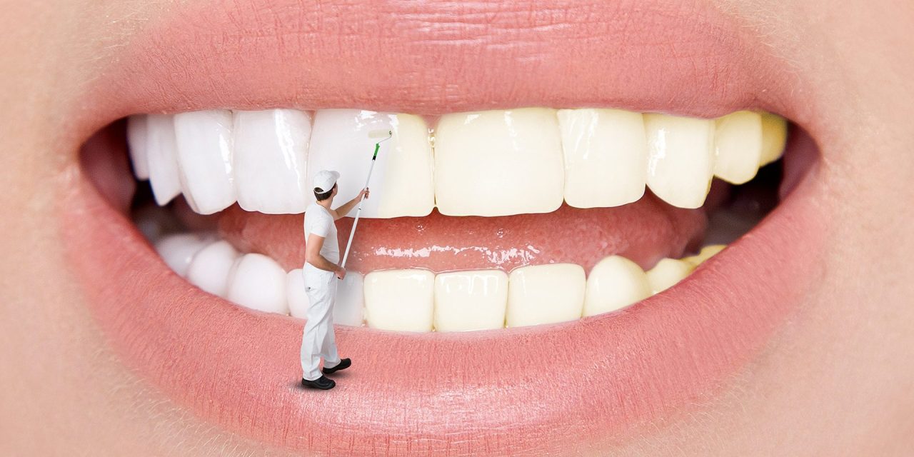 Diş beyazlatma zararlı mı?
